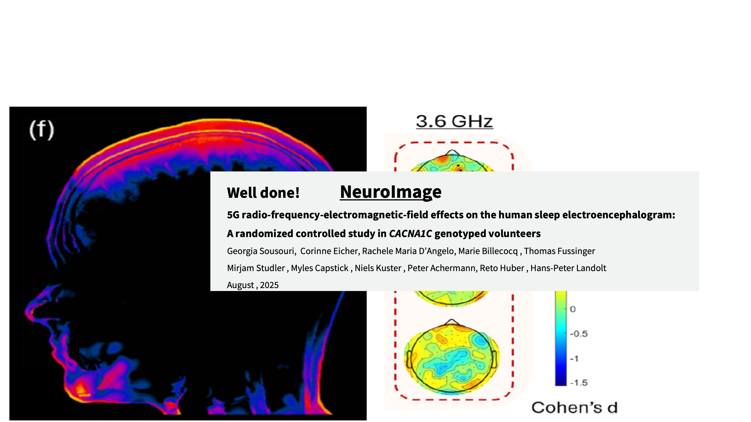 https://www.sciencedirect.com/science/article/pii/S105381192500343X?via%3Dihub